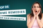 Hair Loss Causes, Solutions, and Home Remedies